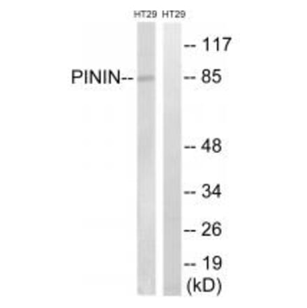 Western blot - PNN Antibody from Signalway Antibody (34907) - Antibodies.com