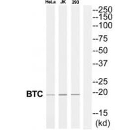 Western blot - BTC Antibody from Signalway Antibody (34927) - Antibodies.com