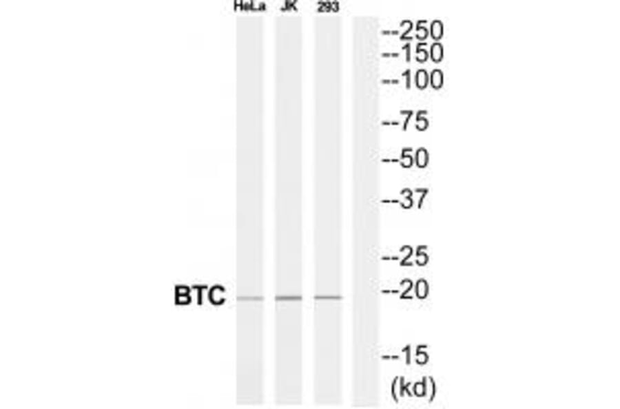 Western blot - BTC Antibody from Signalway Antibody (34927) - Antibodies.com