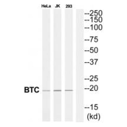 Western blot - BTC Antibody from Signalway Antibody (34927) - Antibodies.com