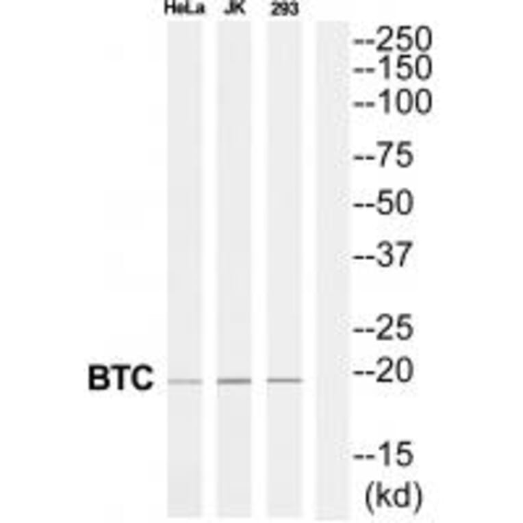 Western blot - BTC Antibody from Signalway Antibody (34927) - Antibodies.com