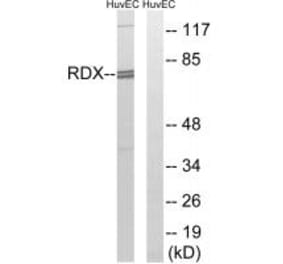 Western blot - RDX Antibody from Signalway Antibody (34955) - Antibodies.com