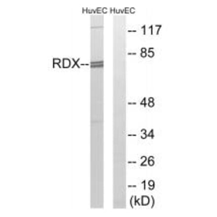 Western blot - RDX Antibody from Signalway Antibody (34955) - Antibodies.com