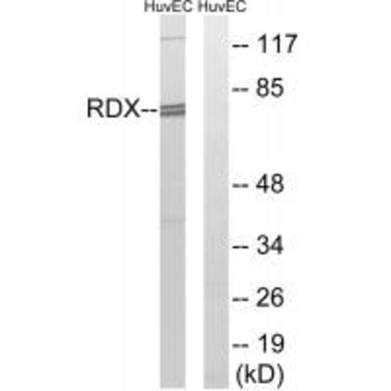 Western blot - RDX Antibody from Signalway Antibody (34955) - Antibodies.com