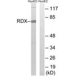Western blot - RDX Antibody from Signalway Antibody (34955) - Antibodies.com