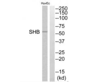 Western blot - SHB Antibody from Signalway Antibody (35039) - Antibodies.com