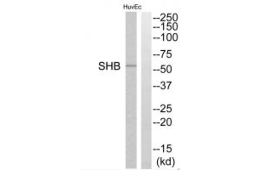 Western blot - SHB Antibody from Signalway Antibody (35039) - Antibodies.com