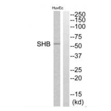 Western blot - SHB Antibody from Signalway Antibody (35039) - Antibodies.com