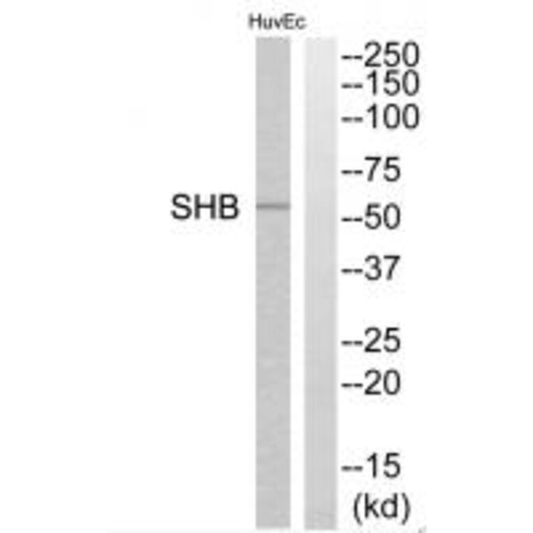Western blot - SHB Antibody from Signalway Antibody (35039) - Antibodies.com