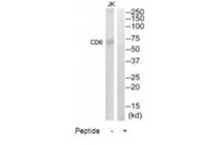 Western blot - CD6 Antibody from Signalway Antibody (35088) - Antibodies.com
