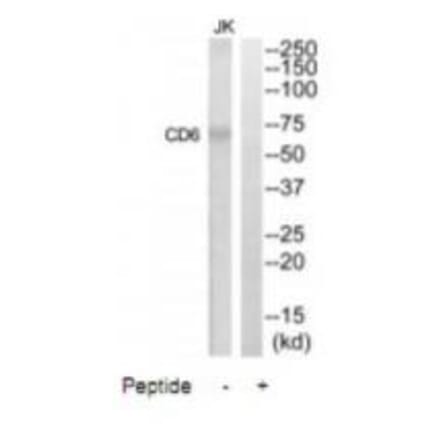Western blot - CD6 Antibody from Signalway Antibody (35088) - Antibodies.com