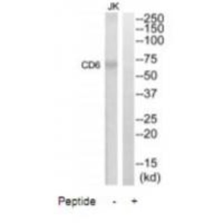 Western blot - CD6 Antibody from Signalway Antibody (35088) - Antibodies.com