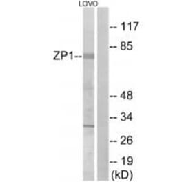 Western blot - ZP1 Antibody from Signalway Antibody (35166) - Antibodies.com