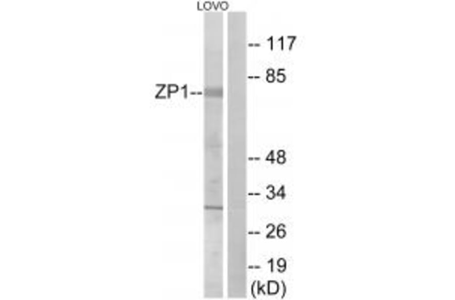 Western blot - ZP1 Antibody from Signalway Antibody (35166) - Antibodies.com