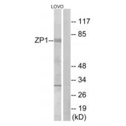 Western blot - ZP1 Antibody from Signalway Antibody (35166) - Antibodies.com