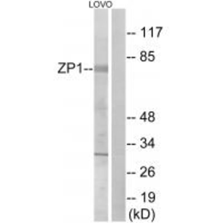 Western blot - ZP1 Antibody from Signalway Antibody (35166) - Antibodies.com