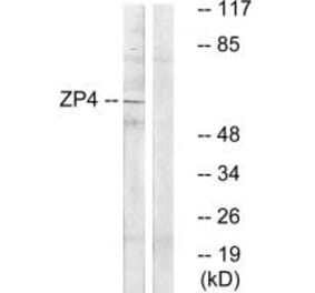 Western blot - ZP4 Antibody from Signalway Antibody (35167) - Antibodies.com