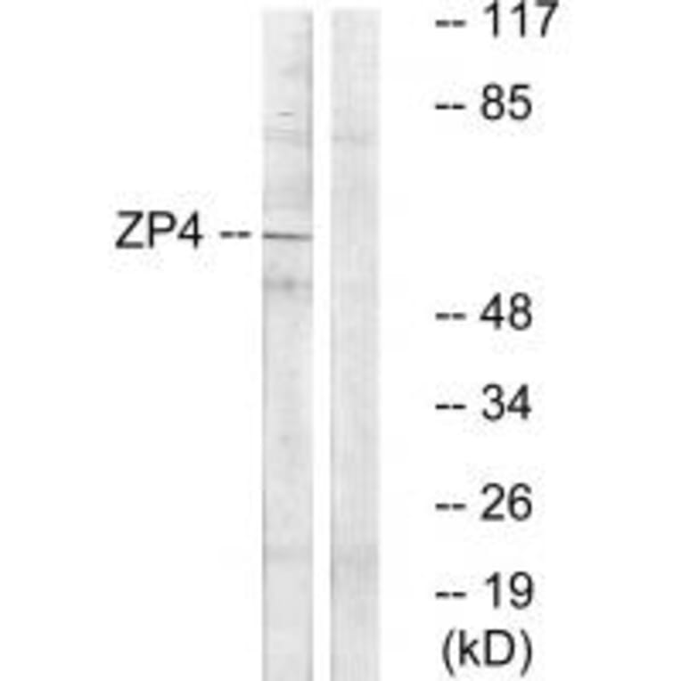Western blot - ZP4 Antibody from Signalway Antibody (35167) - Antibodies.com
