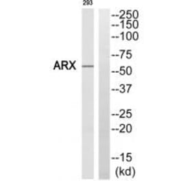 Western blot - ARX Antibody from Signalway Antibody (35194) - Antibodies.com