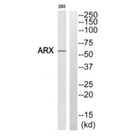 Western blot - ARX Antibody from Signalway Antibody (35194) - Antibodies.com