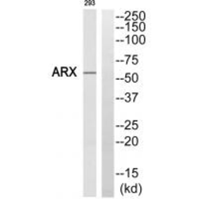 Western blot - ARX Antibody from Signalway Antibody (35194) - Antibodies.com