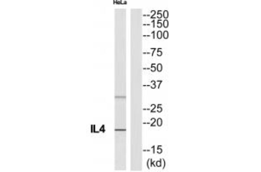 Western blot - IL4 Antibody from Signalway Antibody (35227) - Antibodies.com