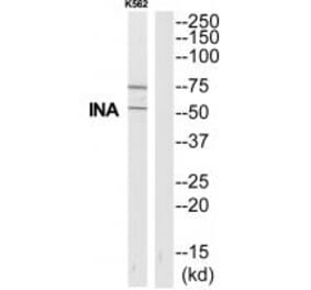 Western blot - INA Antibody from Signalway Antibody (35325) - Antibodies.com