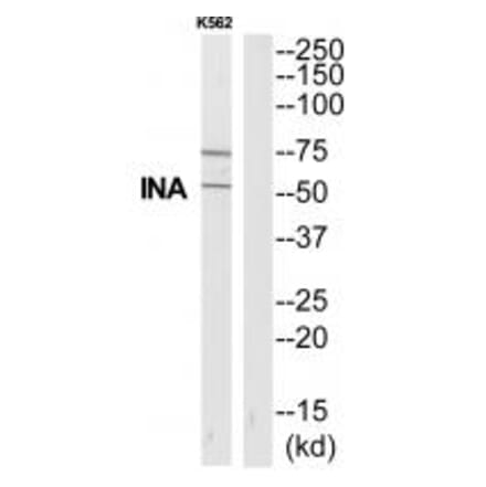 Western blot - INA Antibody from Signalway Antibody (35325) - Antibodies.com