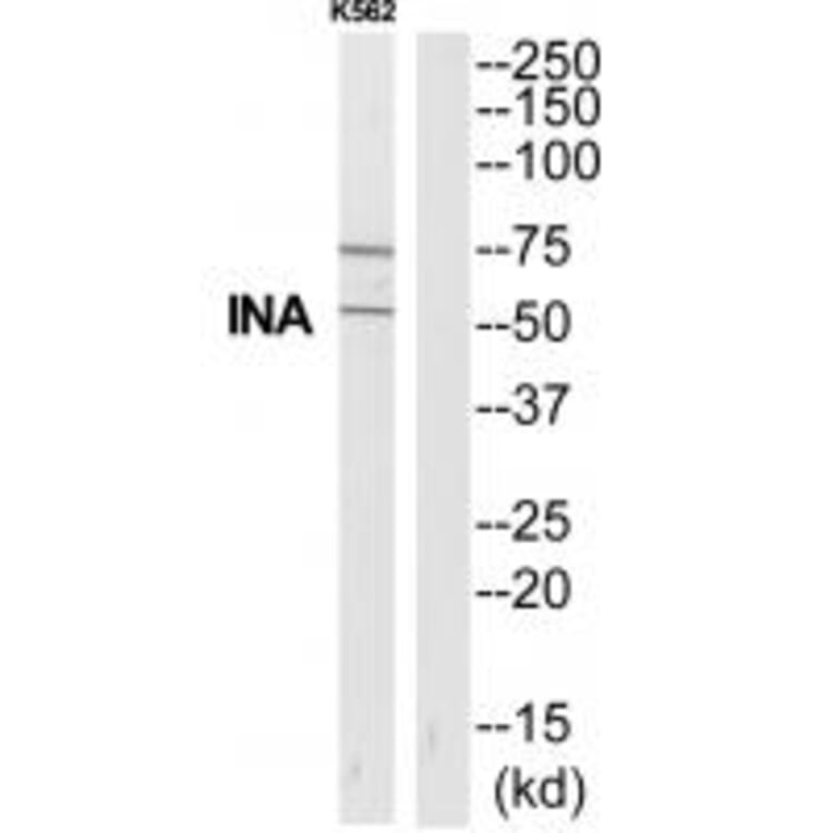 Western blot - INA Antibody from Signalway Antibody (35325) - Antibodies.com