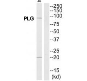 Western blot - PLG Antibody from Signalway Antibody (35329) - Antibodies.com