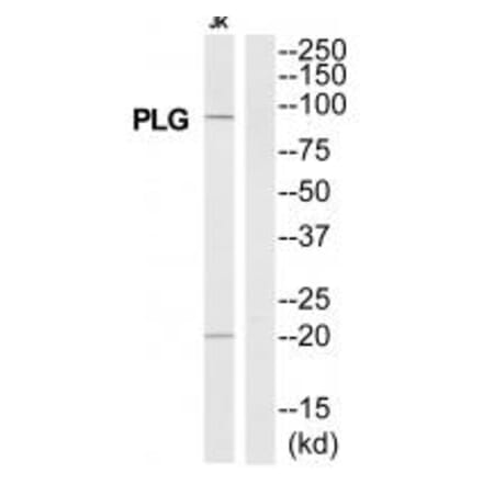 Western blot - PLG Antibody from Signalway Antibody (35329) - Antibodies.com