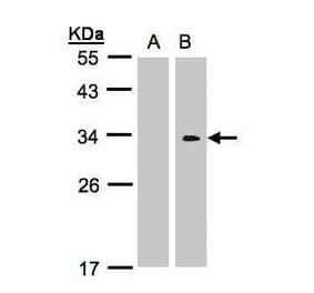 Western blot - CRK Antibody from Signalway Antibody (35352) - Antibodies.com