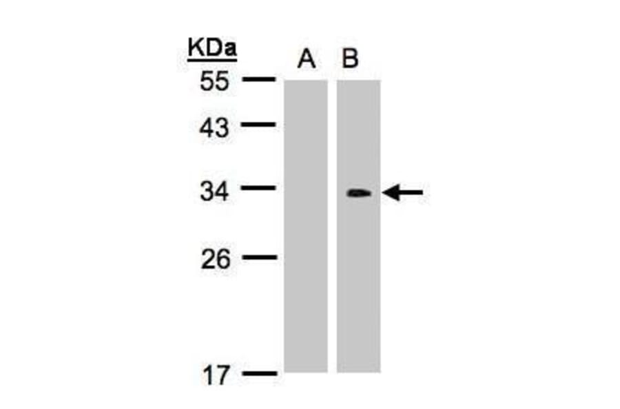 Western blot - CRK Antibody from Signalway Antibody (35352) - Antibodies.com
