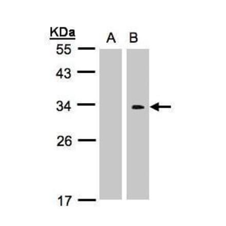 Western blot - CRK Antibody from Signalway Antibody (35352) - Antibodies.com