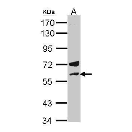 Lck Antibody from Signalway Antibody (35363) - Antibodies.com