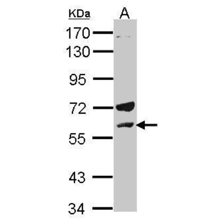 Lck Antibody from Signalway Antibody (35363) - Antibodies.com