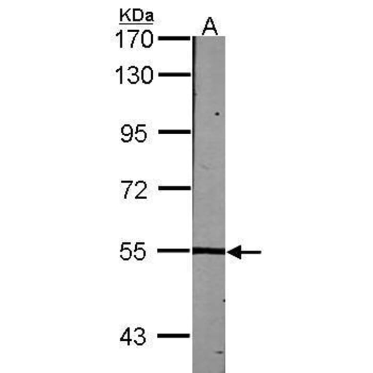 Lck Antibody from Signalway Antibody (35363) - Antibodies.com