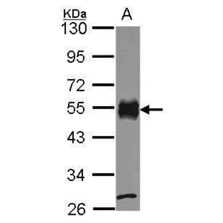 CD2 Antibody from Signalway Antibody (35379) - Antibodies.com