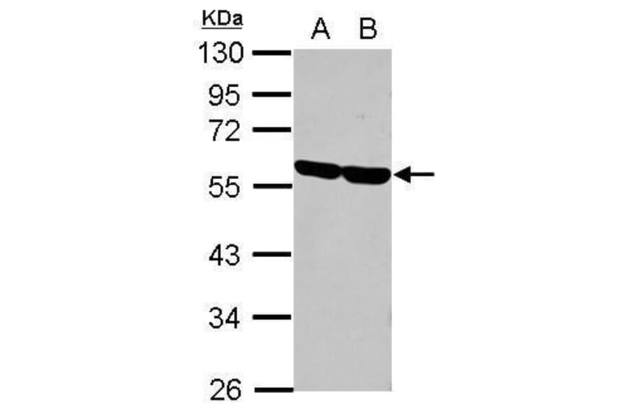 CD2 Antibody from Signalway Antibody (35381) - Antibodies.com