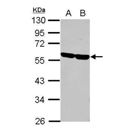 CD2 Antibody from Signalway Antibody (35381) - Antibodies.com