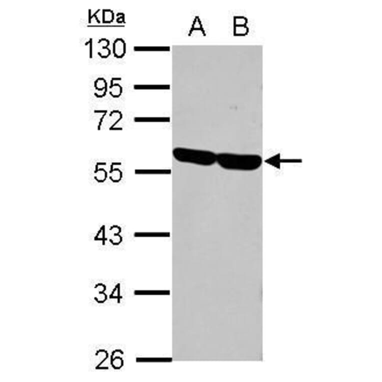 CD2 Antibody from Signalway Antibody (35381) - Antibodies.com