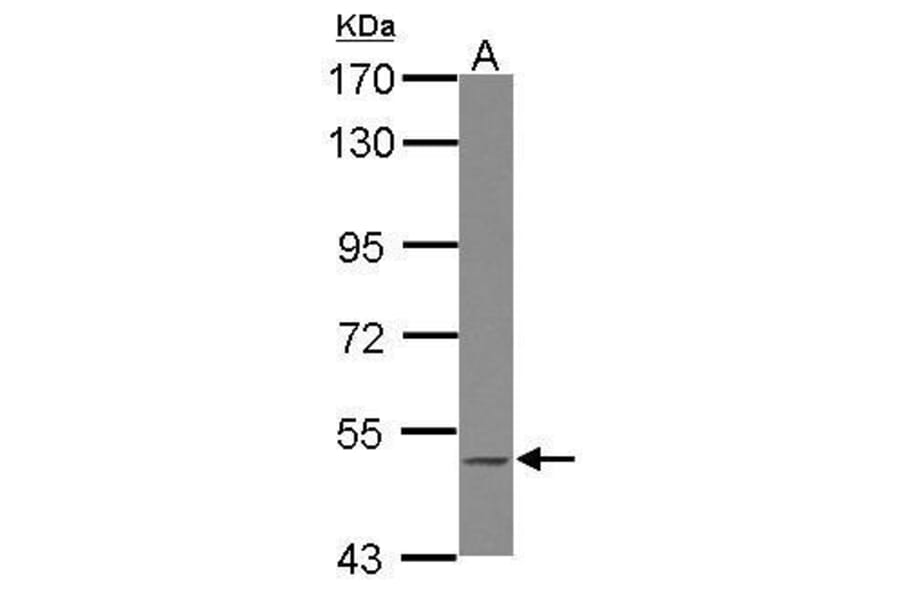 BLK Antibody from Signalway Antibody (35390) - Antibodies.com