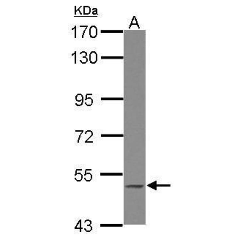 BLK Antibody from Signalway Antibody (35390) - Antibodies.com