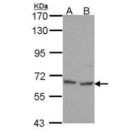 PNK Antibody from Signalway Antibody (35440) - Antibodies.com