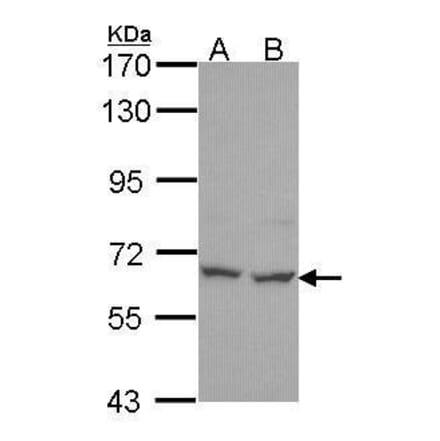PNK Antibody from Signalway Antibody (35440) - Antibodies.com