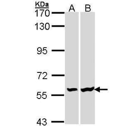 Lck Antibody from Signalway Antibody (35446) - Antibodies.com
