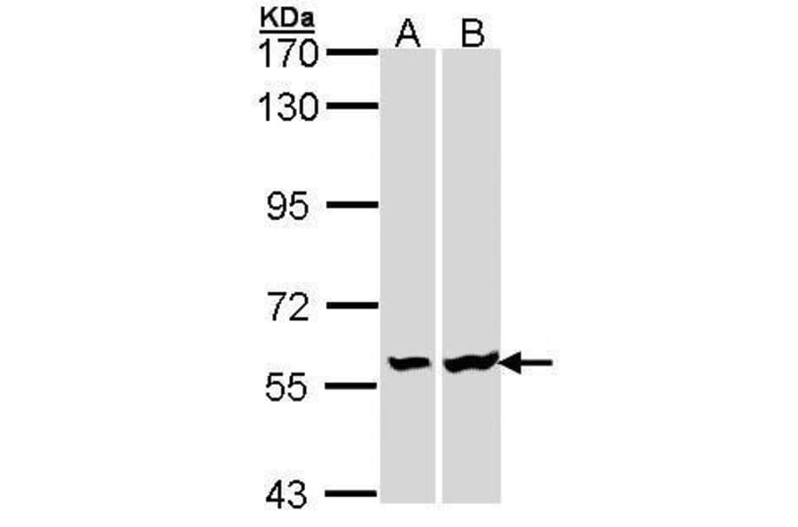 Lck Antibody from Signalway Antibody (35446) - Antibodies.com