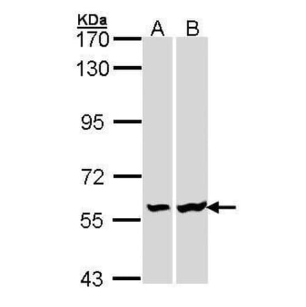 Lck Antibody from Signalway Antibody (35446) - Antibodies.com