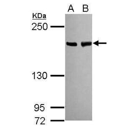 BLM Antibody from Signalway Antibody (35460) - Antibodies.com