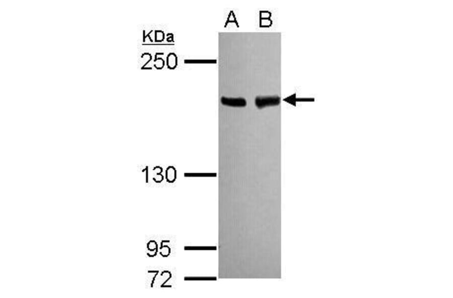 BLM Antibody from Signalway Antibody (35460) - Antibodies.com